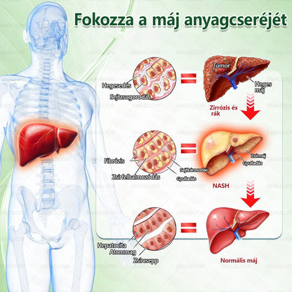 D🇭🇺Európai egészségügyi előírásoknak megfelelő · 👩‍⚕️Orvosi szakértők által ajánlott termék| 🎁 SM𝗔𝗦𝗨O® Glumasetide 8 az 1-ben Karcsú és Egészséges Nano Mikrotűs Tapasz