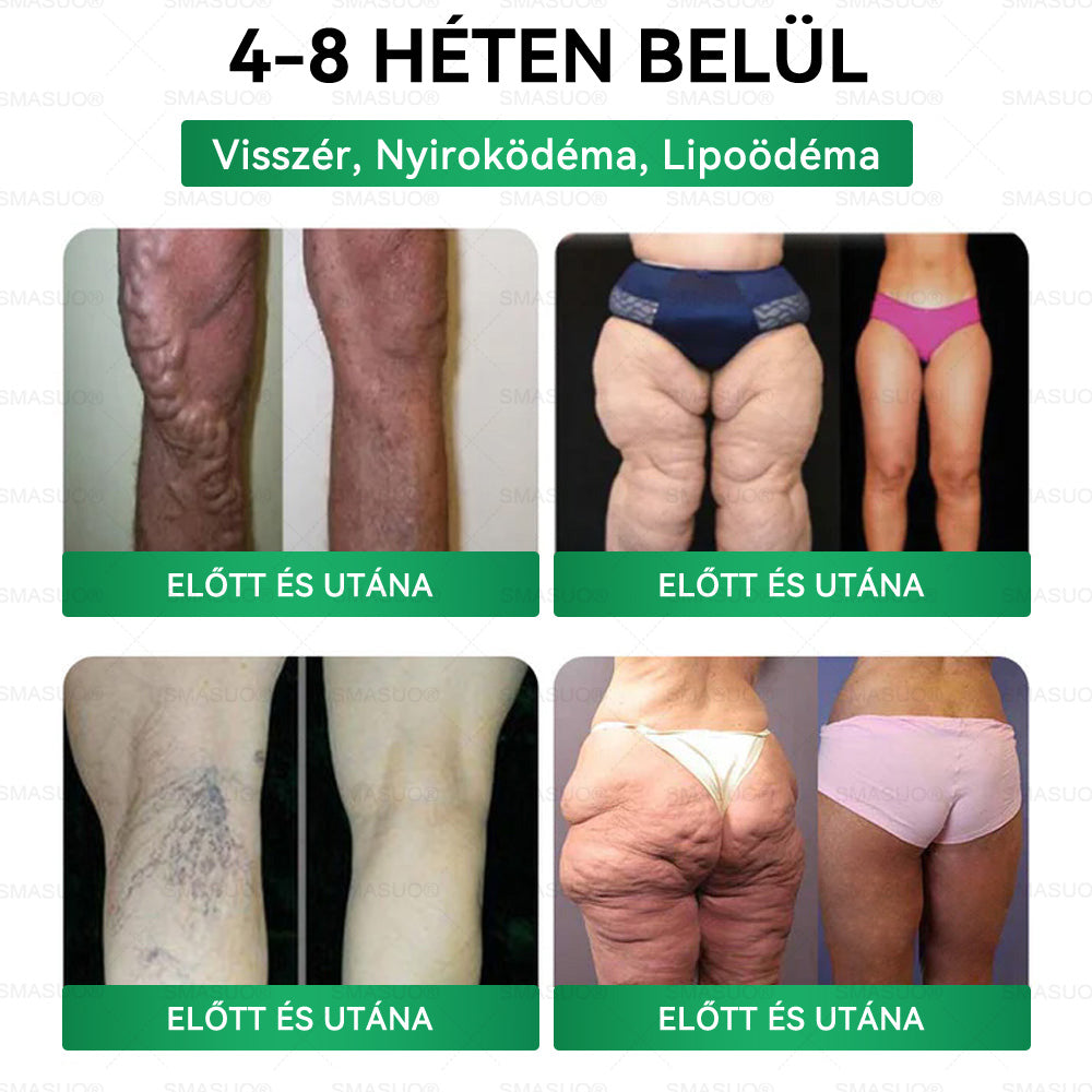 D🇭🇺Európai egészségügyi előírásoknak megfelelő · 👩‍⚕️Orvosi szakértők által ajánlott termék| 🎁 SM𝗔𝗦𝗨O® Glumasetide 8 az 1-ben Karcsú és Egészséges Nano Mikrotűs Tapasz