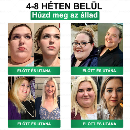 D🇭🇺Európai egészségügyi előírásoknak megfelelő · 👩‍⚕️Orvosi szakértők által ajánlott termék| 🎁 SM𝗔𝗦𝗨O® Glumasetide 8 az 1-ben Karcsú és Egészséges Nano Mikrotűs Tapasz