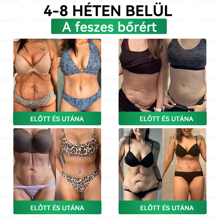 D🇭🇺Európai egészségügyi előírásoknak megfelelő · 👩‍⚕️Orvosi szakértők által ajánlott termék| 🎁 SM𝗔𝗦𝗨O® Glumasetide 8 az 1-ben Karcsú és Egészséges Nano Mikrotűs Tapasz